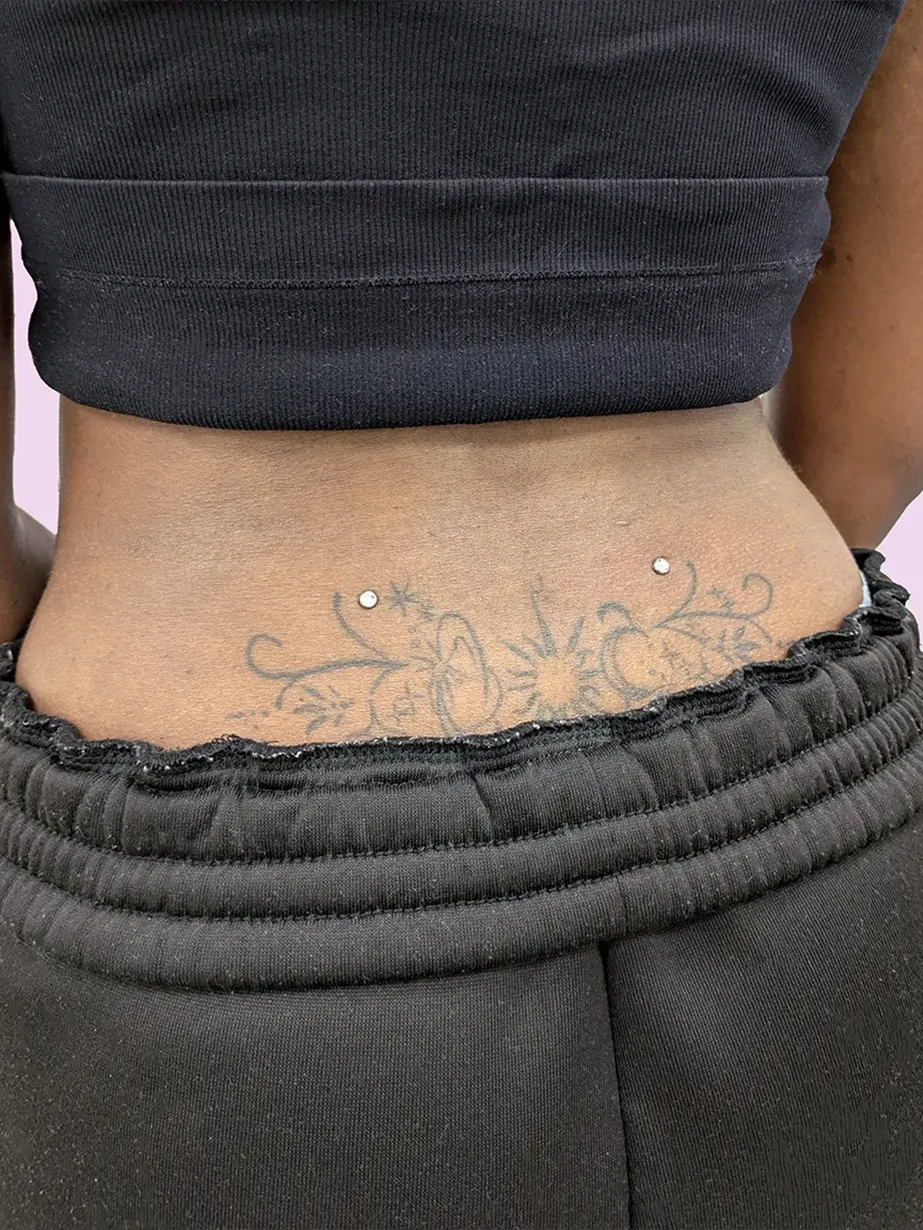 Close up of a pair of back dermals